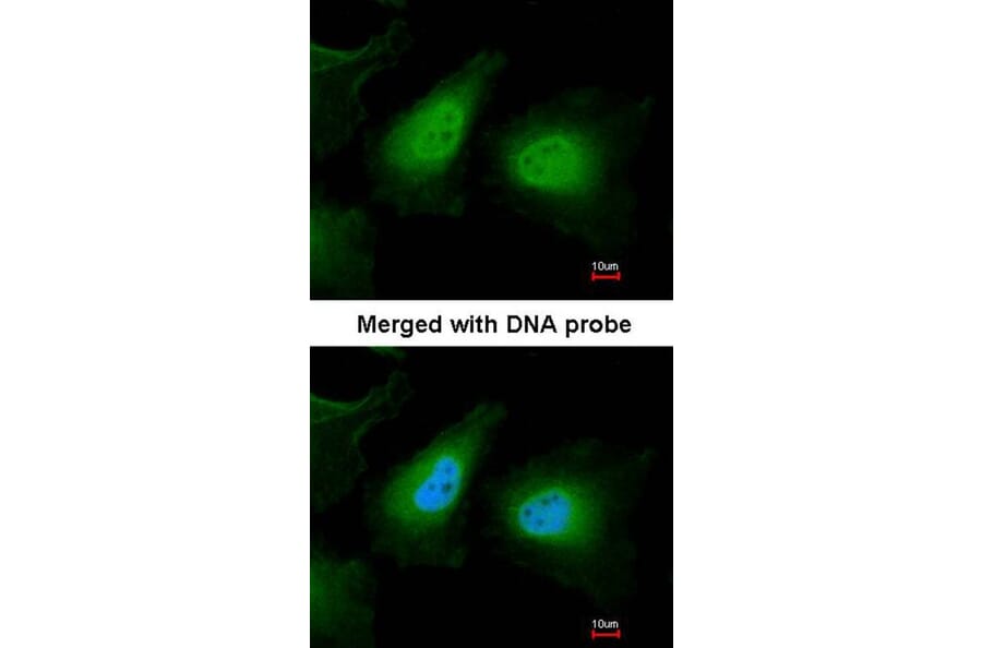 Immunofluorescence - ULK2 antibody from Signalway Antibody (22739) - Antibodies.com