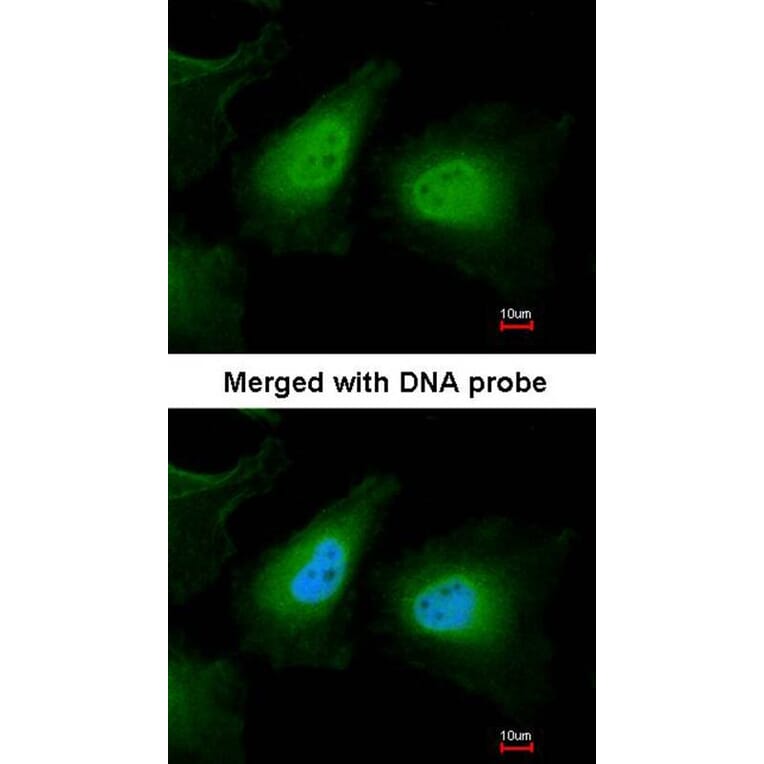 Immunofluorescence - ULK2 antibody from Signalway Antibody (22739) - Antibodies.com