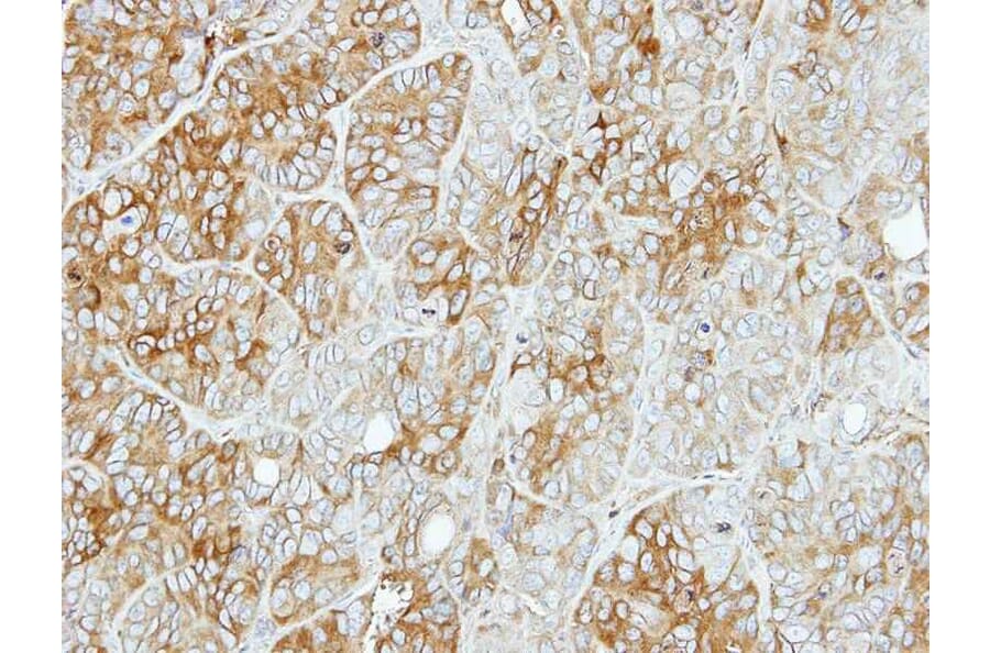 Immunohistochemistry - PFKL antibody from Signalway Antibody (22748) - Antibodies.com