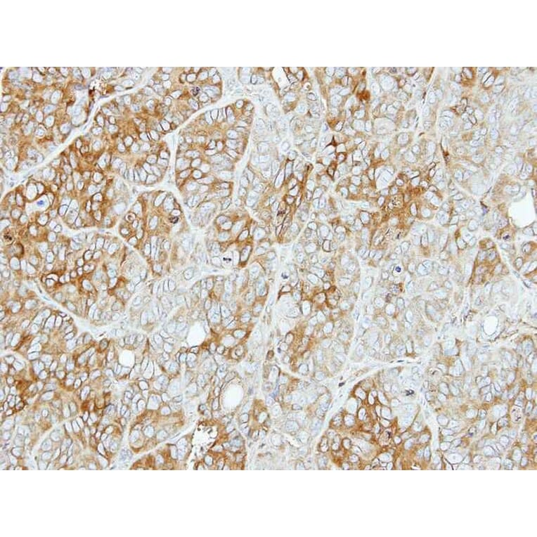 Immunohistochemistry - PFKL antibody from Signalway Antibody (22748) - Antibodies.com