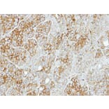 Immunohistochemistry - PFKL antibody from Signalway Antibody (22748) - Antibodies.com