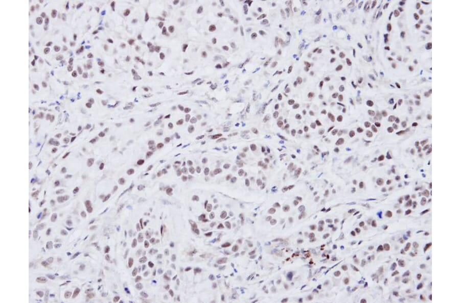 Immunohistochemistry - ATRX antibody from Signalway Antibody (22768) - Antibodies.com