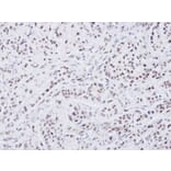 Immunohistochemistry - ATRX antibody from Signalway Antibody (22768) - Antibodies.com