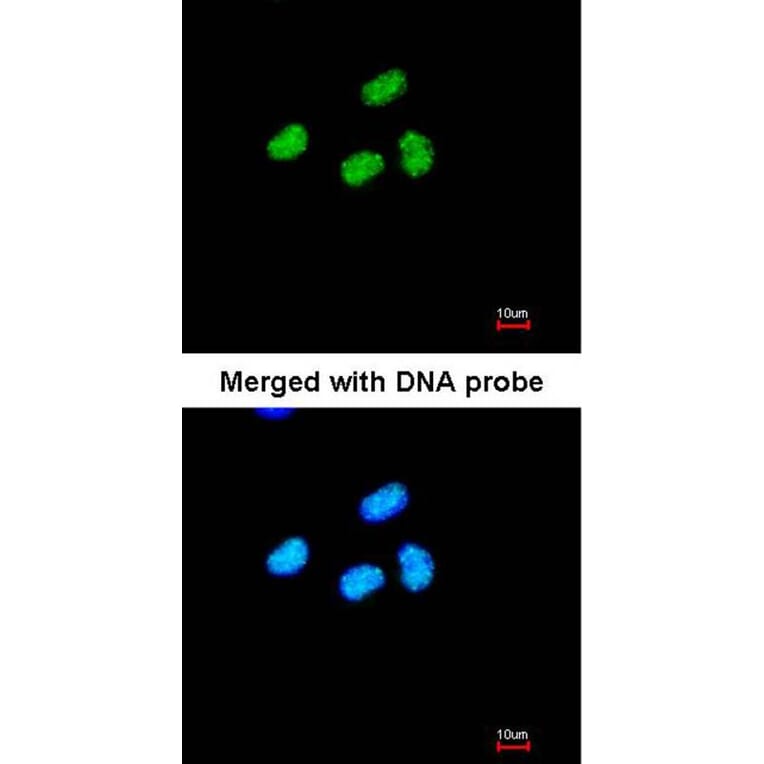 Immunofluorescence - ATRX antibody from Signalway Antibody (22768) - Antibodies.com