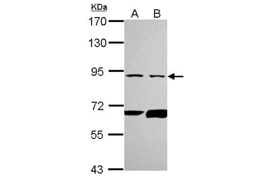 PFKL antibody from Signalway Antibody (22786) - Antibodies.com