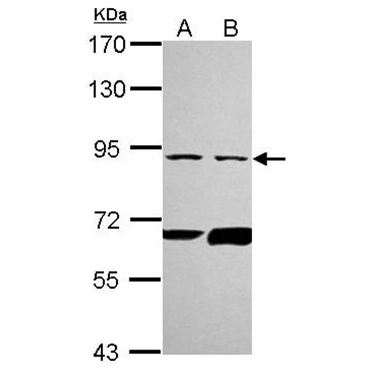 PFKL antibody from Signalway Antibody (22786) - Antibodies.com