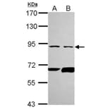PFKL antibody from Signalway Antibody (22786) - Antibodies.com