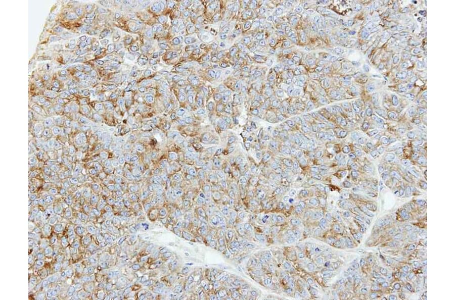Immunohistochemistry - PFKL antibody from Signalway Antibody (22786) - Antibodies.com