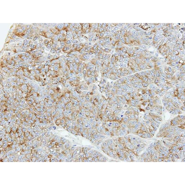 Immunohistochemistry - PFKL antibody from Signalway Antibody (22786) - Antibodies.com