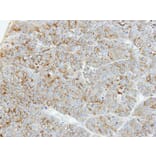 Immunohistochemistry - PFKL antibody from Signalway Antibody (22786) - Antibodies.com