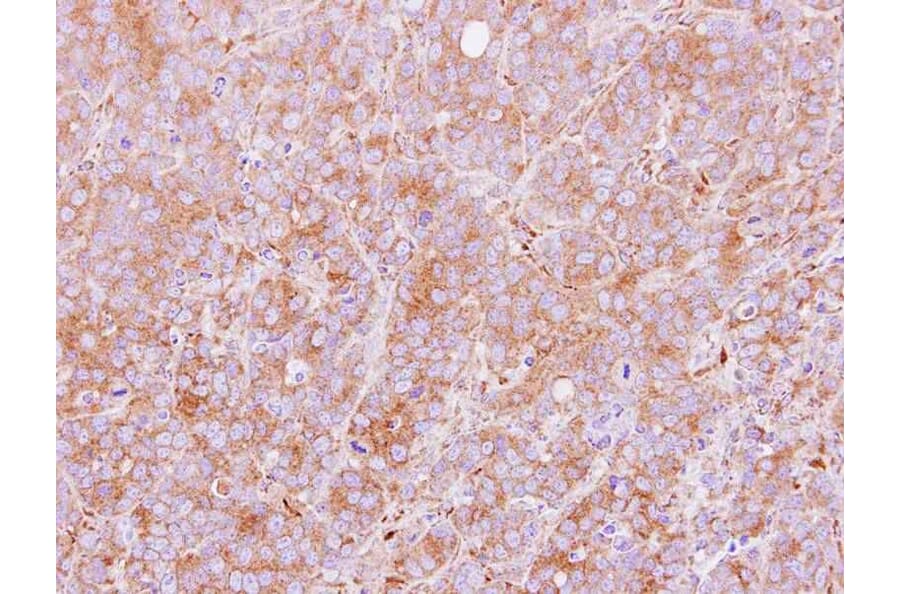 Immunohistochemistry - PDIR antibody from Signalway Antibody (22796) - Antibodies.com