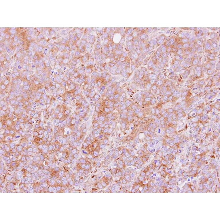 Immunohistochemistry - PDIR antibody from Signalway Antibody (22796) - Antibodies.com