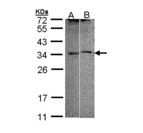 FHL5 antibody from Signalway Antibody (22811) - Antibodies.com