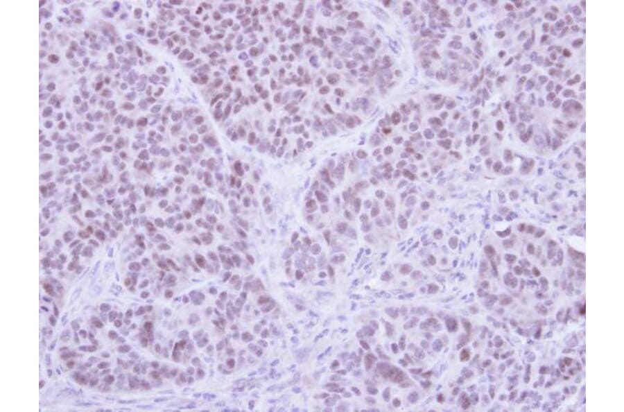 Immunohistochemistry - FHL5 antibody from Signalway Antibody (22811) - Antibodies.com