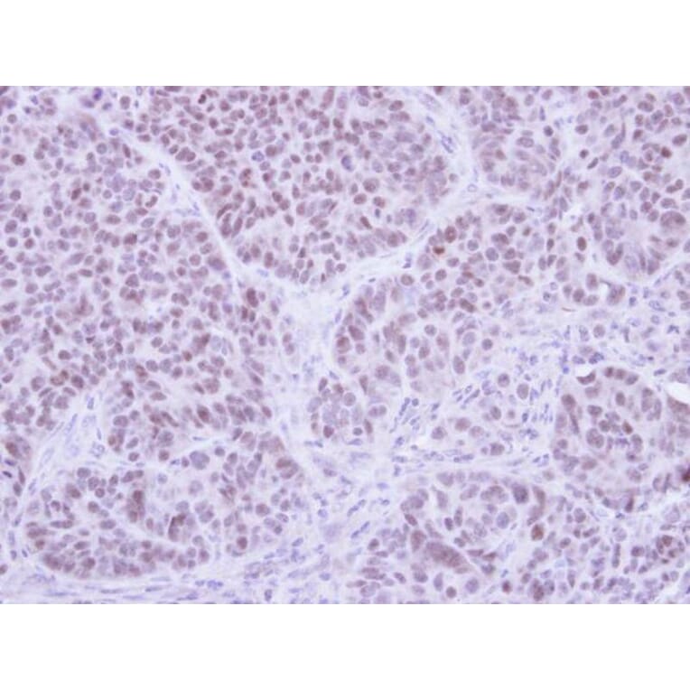 Immunohistochemistry - FHL5 antibody from Signalway Antibody (22811) - Antibodies.com