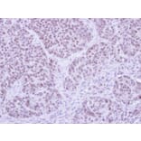 Immunohistochemistry - FHL5 antibody from Signalway Antibody (22811) - Antibodies.com