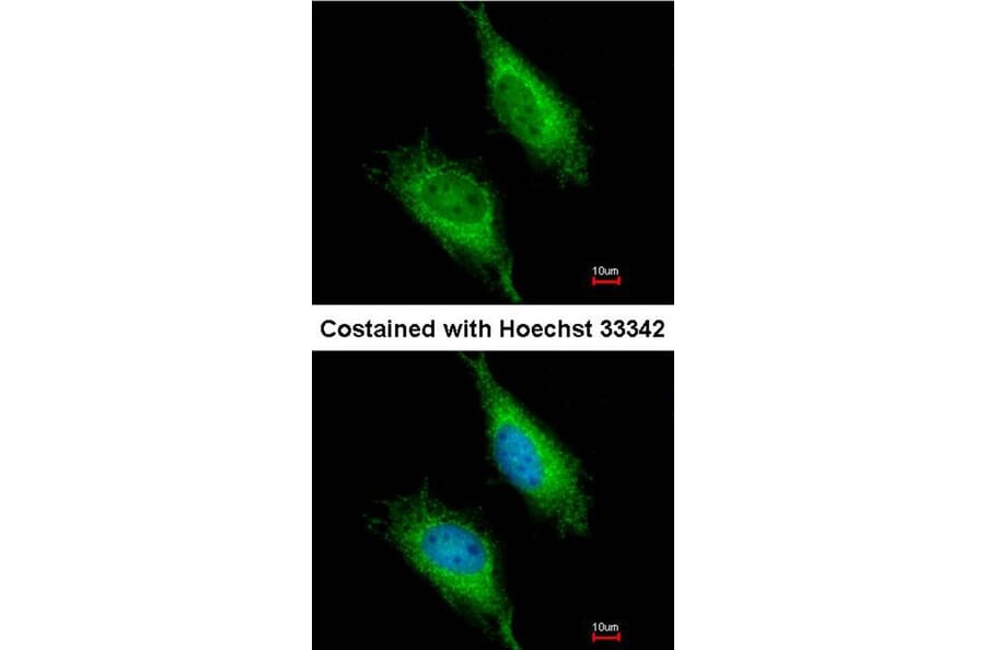 Immunofluorescence - FAST antibody from Signalway Antibody (22837) - Antibodies.com