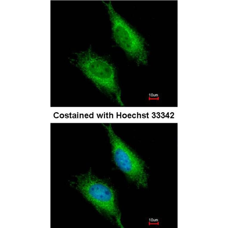 Immunofluorescence - FAST antibody from Signalway Antibody (22837) - Antibodies.com