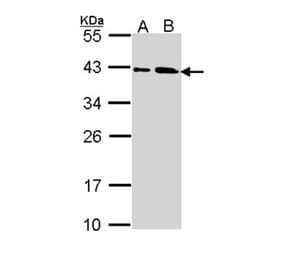 SAE1 antibody from Signalway Antibody (22850) - Antibodies.com