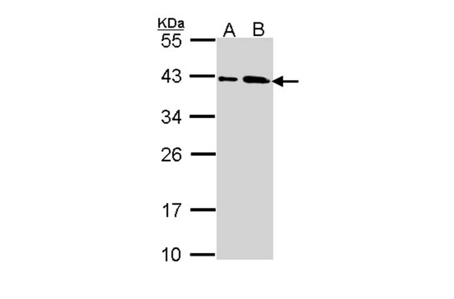 SAE1 antibody from Signalway Antibody (22850) - Antibodies.com