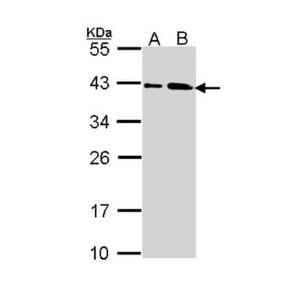 SAE1 antibody from Signalway Antibody (22850) - Antibodies.com