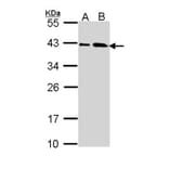 SAE1 antibody from Signalway Antibody (22850) - Antibodies.com