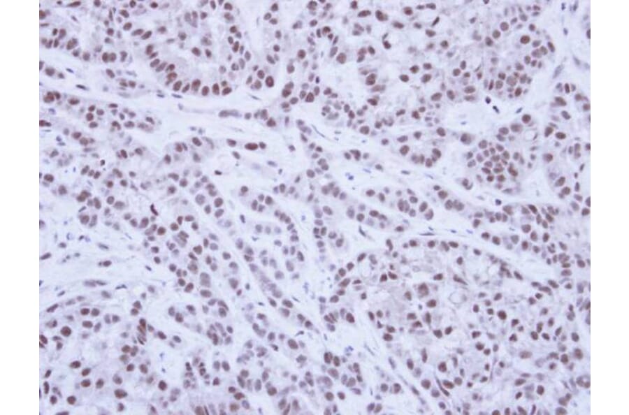 Immunohistochemistry - SAE1 antibody from Signalway Antibody (22850) - Antibodies.com
