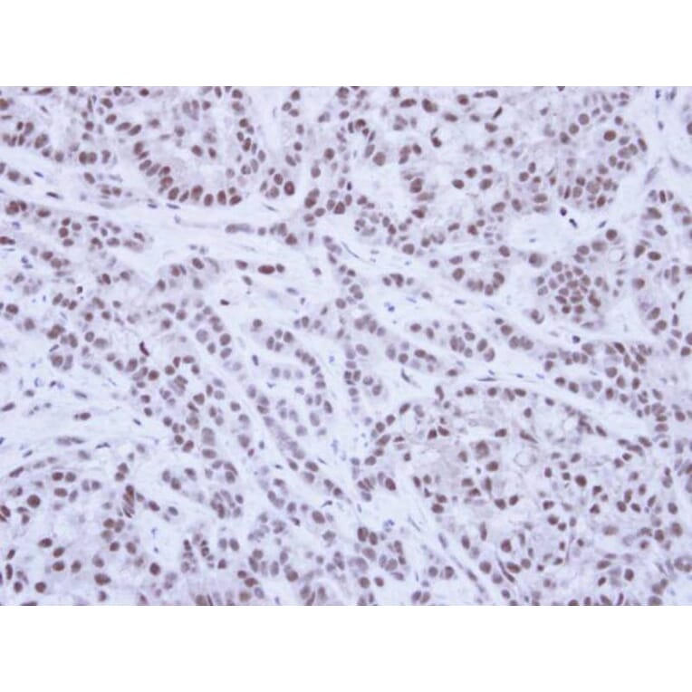 Immunohistochemistry - SAE1 antibody from Signalway Antibody (22850) - Antibodies.com