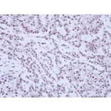 Immunohistochemistry - SAE1 antibody from Signalway Antibody (22850) - Antibodies.com