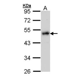 LDB1 antibody from Signalway Antibody (22859) - Antibodies.com