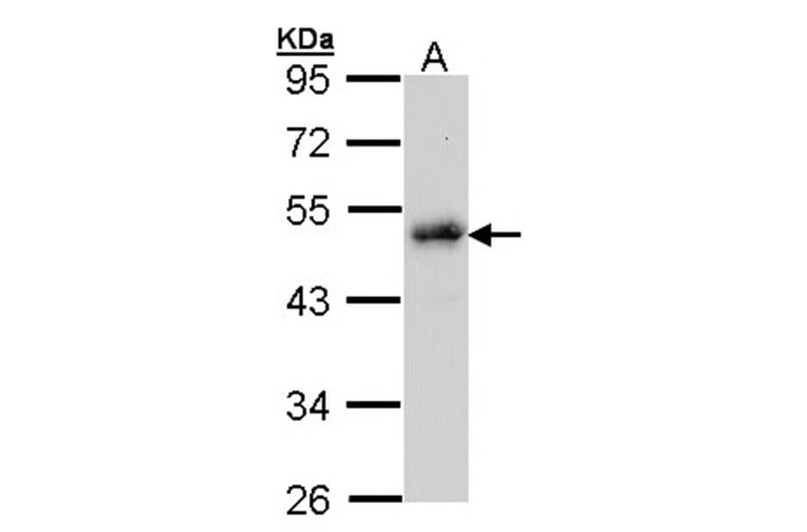 LDB1 antibody from Signalway Antibody (22859) - Antibodies.com