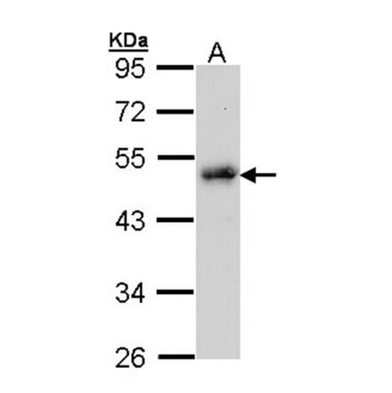LDB1 antibody from Signalway Antibody (22859) - Antibodies.com