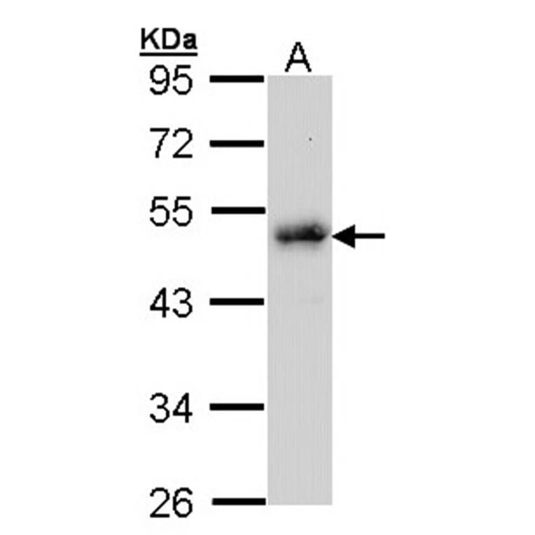 LDB1 antibody from Signalway Antibody (22859) - Antibodies.com