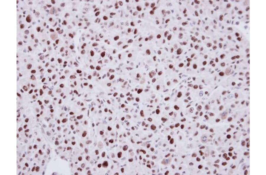 Immunohistochemistry - LDB1 antibody from Signalway Antibody (22859) - Antibodies.com