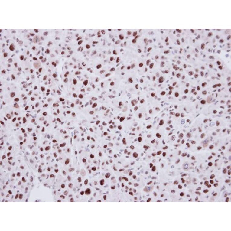 Immunohistochemistry - LDB1 antibody from Signalway Antibody (22859) - Antibodies.com