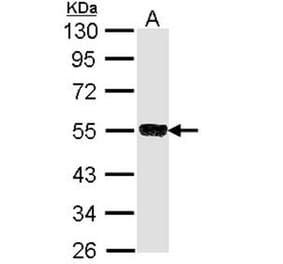 SSA1 antibody from Signalway Antibody (22860) - Antibodies.com