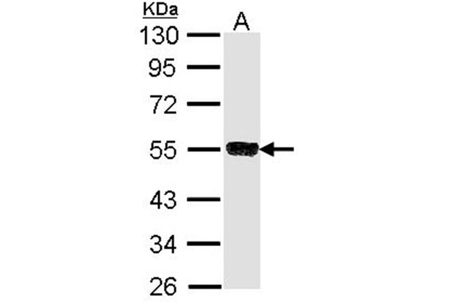SSA1 antibody from Signalway Antibody (22860) - Antibodies.com