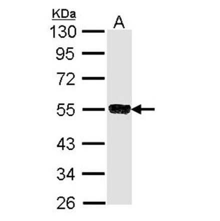 SSA1 antibody from Signalway Antibody (22860) - Antibodies.com