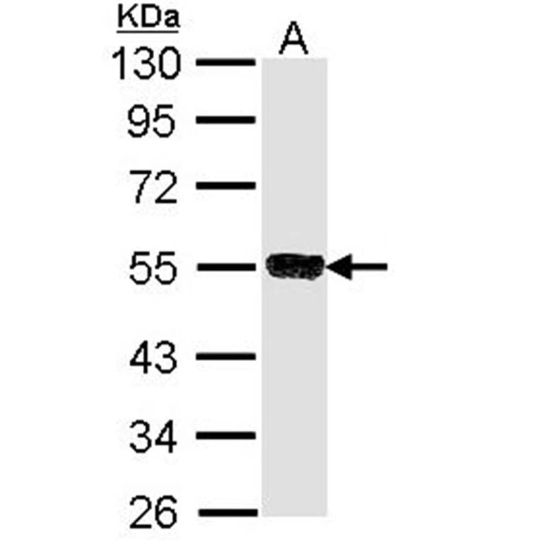 SSA1 antibody from Signalway Antibody (22860) - Antibodies.com