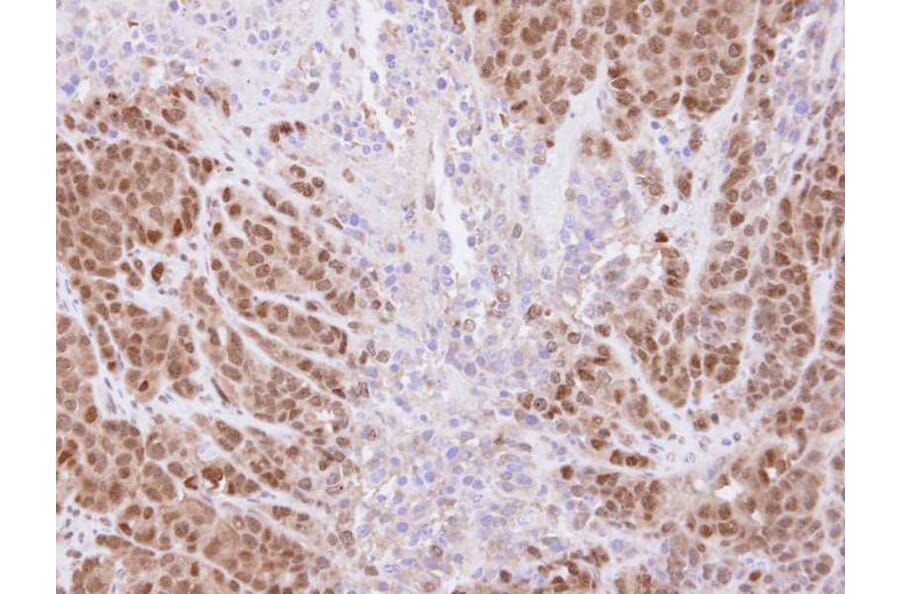 Immunohistochemistry - SSA1 antibody from Signalway Antibody (22860) - Antibodies.com