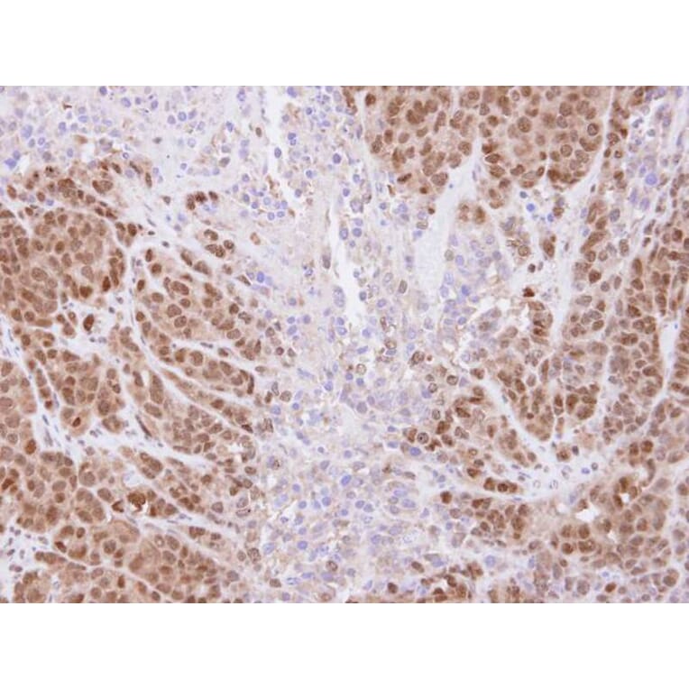 Immunohistochemistry - SSA1 antibody from Signalway Antibody (22860) - Antibodies.com