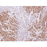 Immunohistochemistry - SSA1 antibody from Signalway Antibody (22860) - Antibodies.com