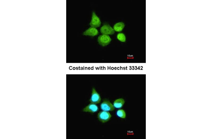 Immunofluorescence - SSA1 antibody from Signalway Antibody (22860) - Antibodies.com