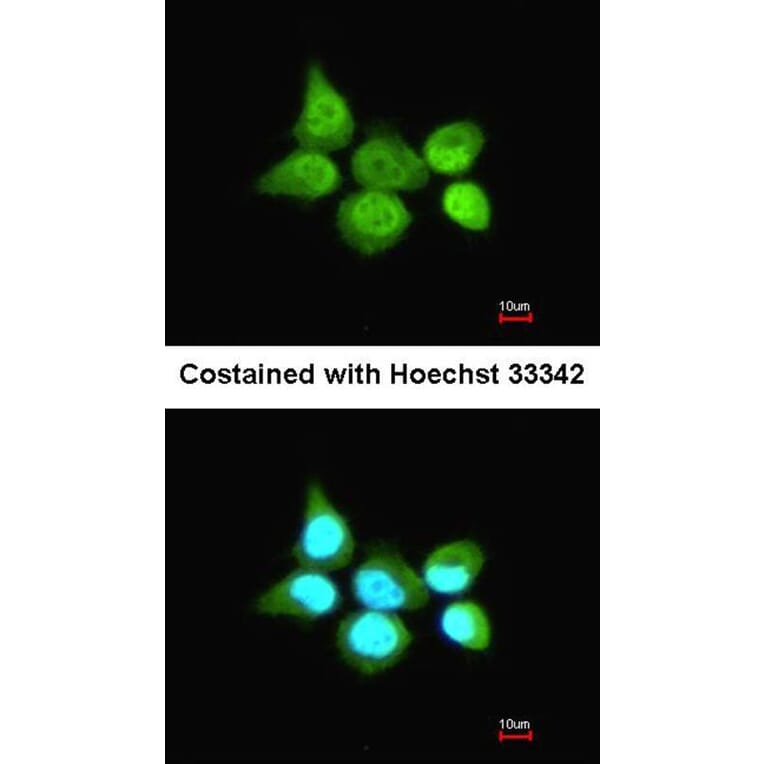 Immunofluorescence - SSA1 antibody from Signalway Antibody (22860) - Antibodies.com