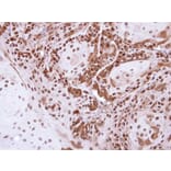Immunohistochemistry - DDB1 antibody from Signalway Antibody (22929) - Antibodies.com