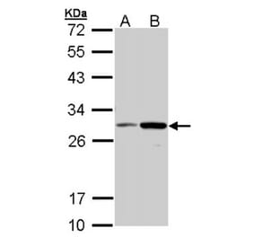 NQO1 antibody from Signalway Antibody (22937) - Antibodies.com