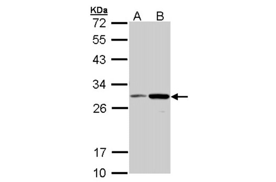 NQO1 antibody from Signalway Antibody (22937) - Antibodies.com
