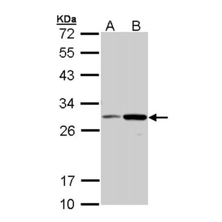 NQO1 antibody from Signalway Antibody (22937) - Antibodies.com