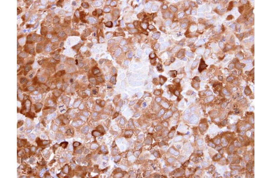Immunohistochemistry - NQO1 antibody from Signalway Antibody (22937) - Antibodies.com