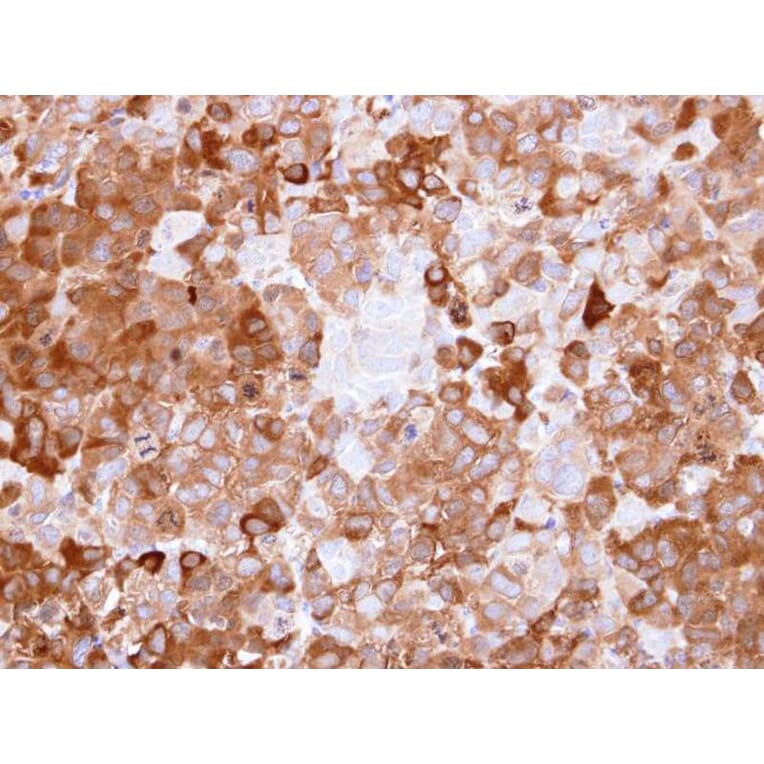 Immunohistochemistry - NQO1 antibody from Signalway Antibody (22937) - Antibodies.com